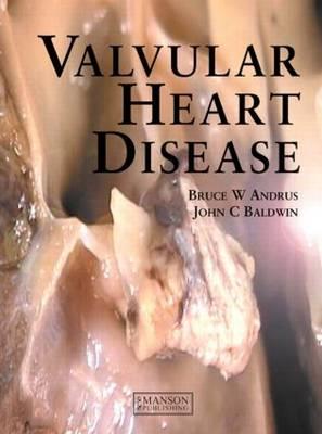 Valvular Heart Disease - Click Image to Close