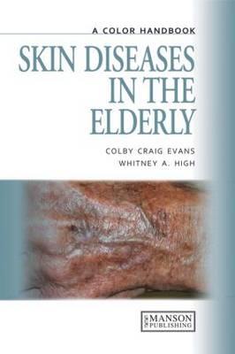 Skin Diseases in the Elderly - Click Image to Close