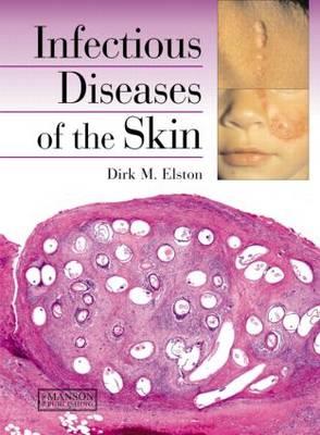 Infectious Diseases of the Skin - Click Image to Close