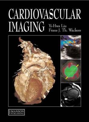 Cardiovascular Imaging - Click Image to Close