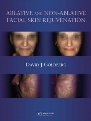 Ablative and Non-ablative Facial Skin Rejuvenation - Click Image to Close