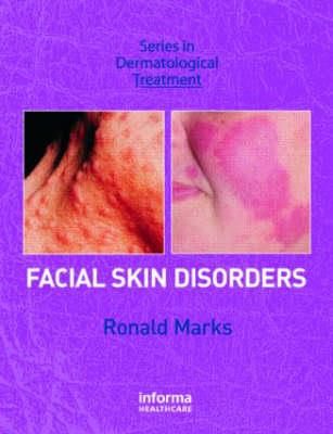 Facial Skin Disorders - Click Image to Close