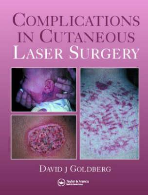 Complications in Laser Cutaneous Surgery - Click Image to Close