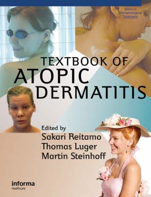 Textbook of Atopic Dermatitis - Click Image to Close