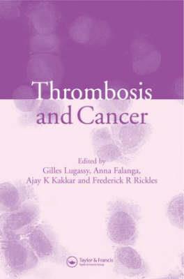 Thrombosis and Cancer - Click Image to Close