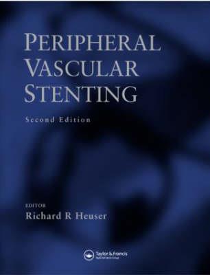 Peripheral Vascular Stenting, Second Edition - Click Image to Close