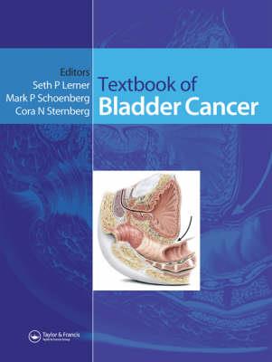 Textbook of Bladder Cancer - Click Image to Close