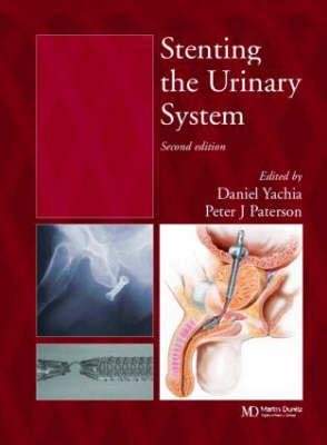 Stenting the Urinary System - Click Image to Close