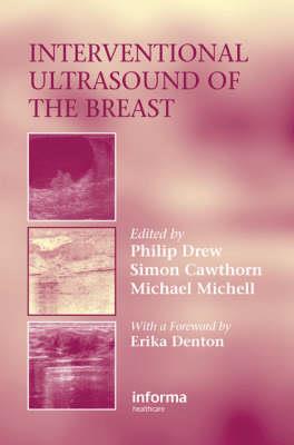 Interventional Ultrasound of the Breast - Click Image to Close