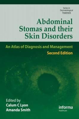 Abdominal Stomas and Their Skin Disorders - Click Image to Close