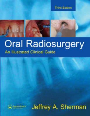 Oral Radiosurgery - Click Image to Close