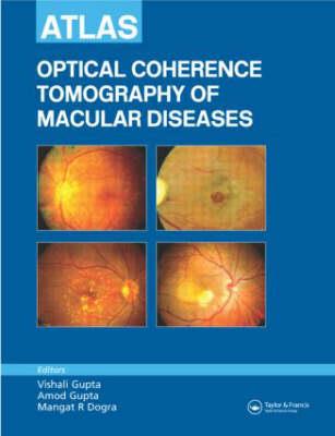 Atlas of Optical Coherence Tomography of Macular Diseases - Click Image to Close