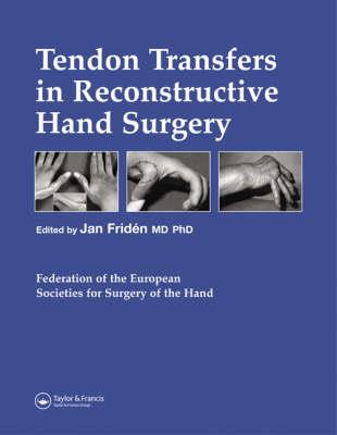 Tendon Transfers in Reconstructive Hand Surgery - Click Image to Close