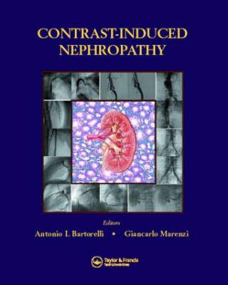 Contrast-Induced Nephropathy in Interventional Cardiovascular Medicine - Click Image to Close