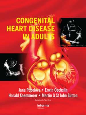 Congenital Heart Disease in Adults - Click Image to Close