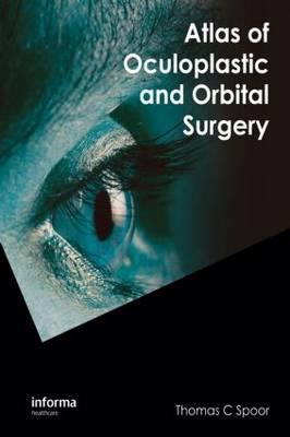 Atlas of Oculoplastic and Orbital Surgery - Click Image to Close