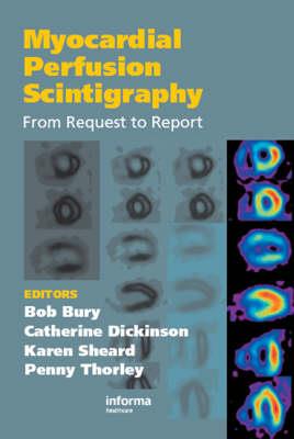 Myocardial Perfusion Scintigraphy - Click Image to Close