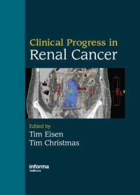 Clinical Progress in Renal Cancer - Click Image to Close