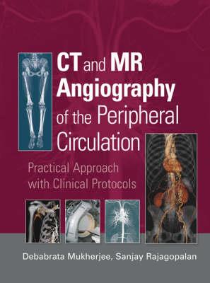 CT and MR Angiography of the Peripheral Circulation - Click Image to Close