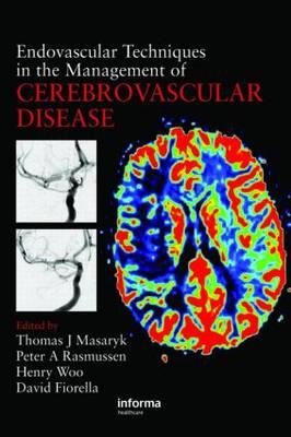 Endovascular Techniques in the Management of Cerebrovascular Disease - Click Image to Close