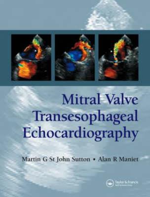 Mitral Valve Transesophageal Echocardiography - Click Image to Close