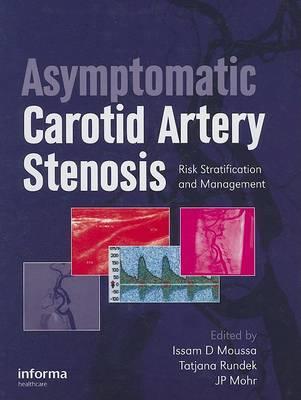 Asymptomatic Carotid Artery Stenosis - Click Image to Close