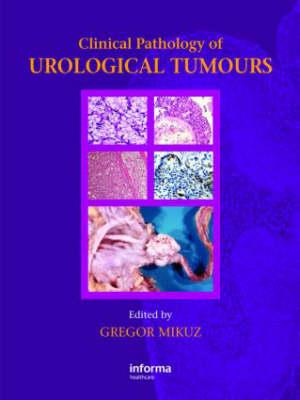 Clinical Pathology of Urological Tumours - Click Image to Close