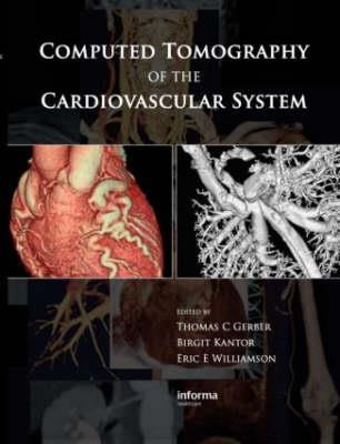 Computed Tomography of the Cardiovascular System - Click Image to Close