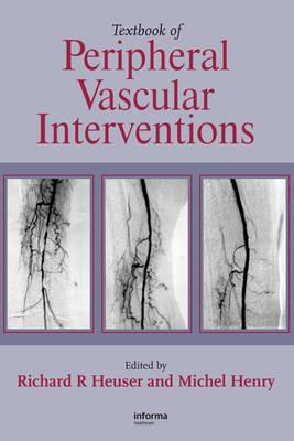 Textbook of Peripheral Vascular Interventions - Click Image to Close