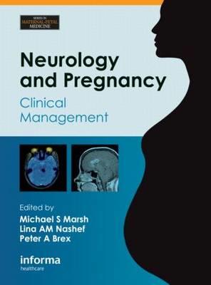 Neurology and Pregnancy - Click Image to Close