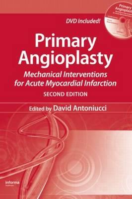 Primary Angioplasty - Click Image to Close