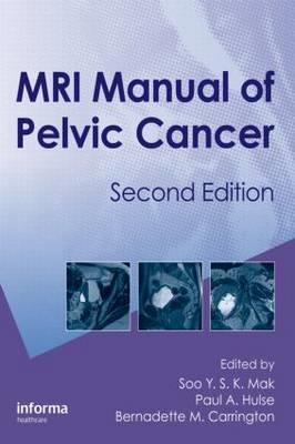 MRI Manual of Pelvic Cancer,Second Edition - Click Image to Close