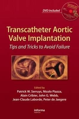 Transcatheter Aortic Valve Implantation - Click Image to Close