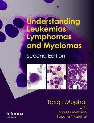 Understanding Leukemias, Lymphomas and Myelomas - Click Image to Close