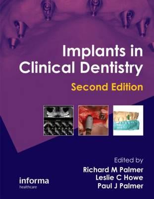 Implants in Clinical Dentistry - Click Image to Close