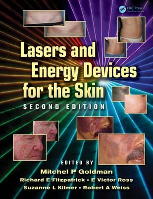 Lasers and Energy Devices for the Skin - Click Image to Close