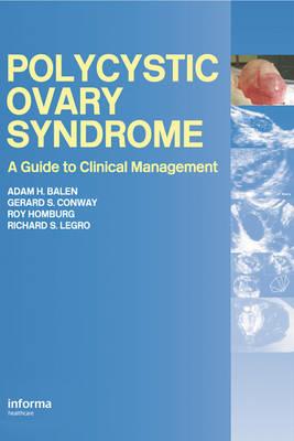 Polycystic Ovary Syndrome - Click Image to Close