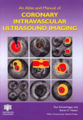 An Atlas and Manual of Coronary Intravascular Ultrasound Imaging - Click Image to Close