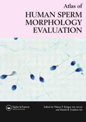 Atlas of Human Sperm Morphology Evaluation - Click Image to Close