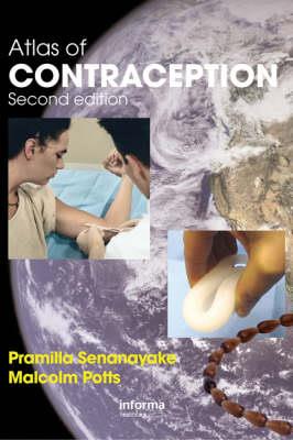 Atlas of Contraception - Click Image to Close