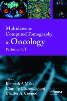 Multi-Detector Computed Tomography in Oncology - Click Image to Close