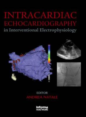 Intracardiac Echocardiography in Interventional Electrophysiology - Click Image to Close