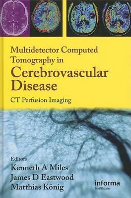 Multidetector Computed Tomography in Cerebrovascular Disease - Click Image to Close