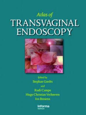 Atlas of Transvaginal Endoscopy - Click Image to Close