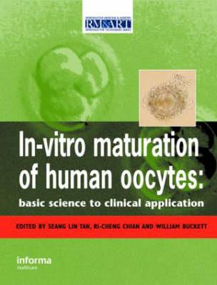 In Vitro Maturation of Human Oocytes - Click Image to Close