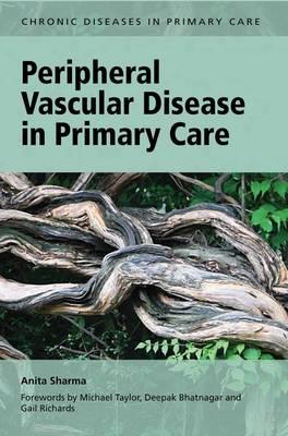 Peripheral Vascular Disease in Primary Care - Click Image to Close