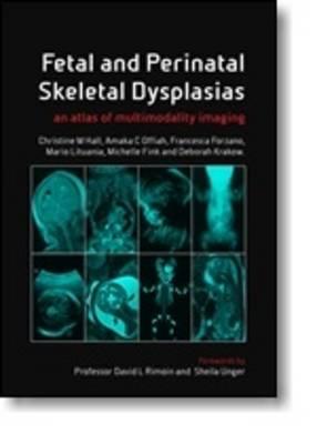 Fetal and Perinatal Skeletal Dysplasias - Click Image to Close