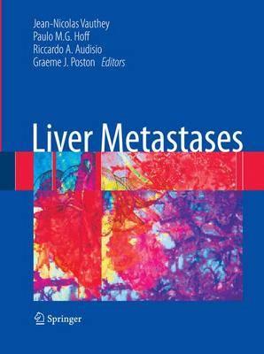 Liver Metastases - Click Image to Close
