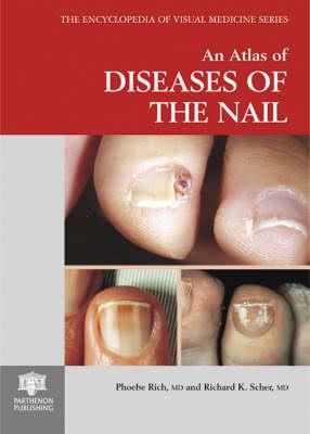 An Atlas of Diseases of the Nail - Click Image to Close