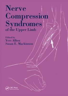 Nerve Compression Syndromes of the Upper Limb - Click Image to Close